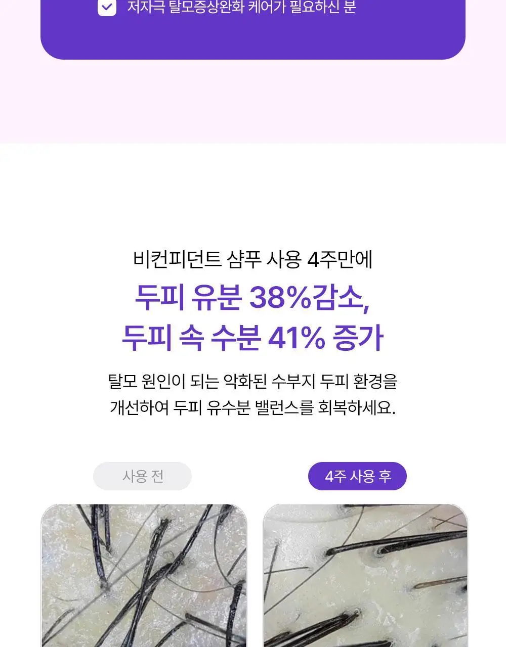 [맞춤형 탈모샴푸] 위드비컨 두피 코렉팅 샴푸 360ml(두피별 샴푸) 상세페이지 11